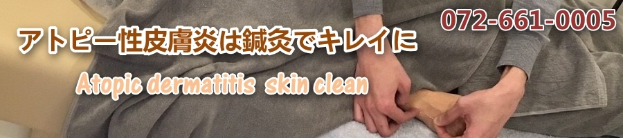 アトピー性皮膚炎